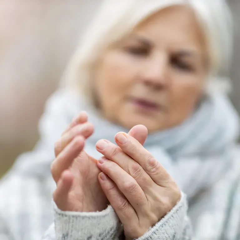 Woman holding her hands together, massaging thumb.