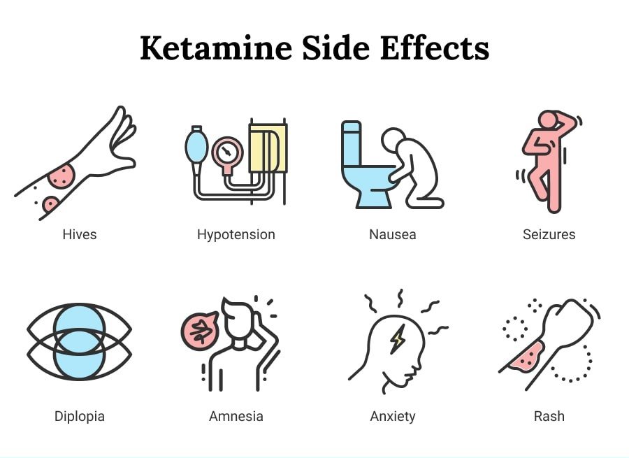 Infographic detailing ketamine therapy side effects and safety measures, emphasizing ketamine therapy safety in San Diego.